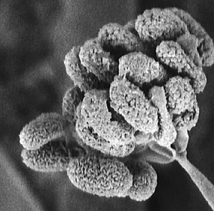 Mold-1-large The risk of using an unqualified mold removal service is not having the mold problem fixed or creating a worse problem. Anyone with health concerns should consult a physician prior to beginning the mold removal.